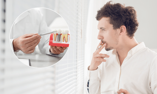 Tỷ lệ cấy implant thành công cho người hút thuốc lá